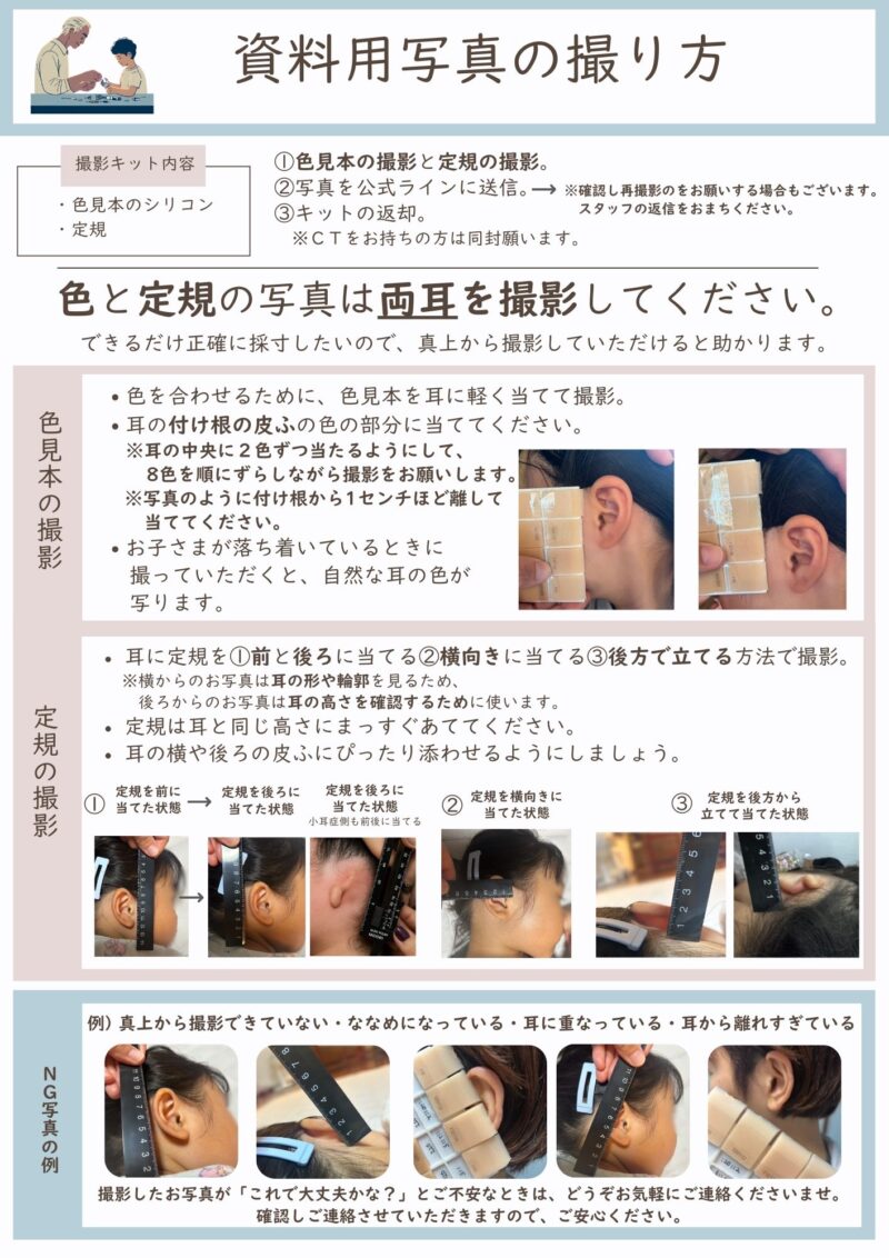 非対面での耳エピテーゼ製作のイメージ